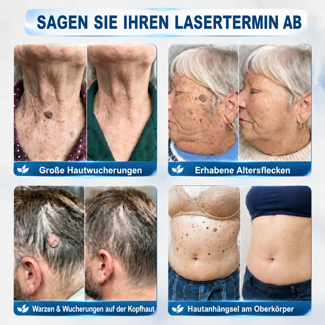1𝐇𝐈𝐒𝐊𝐈𝐍®👩‍⚕️ 𝟕-𝐓𝐚𝐠𝐞-𝐇𝐚𝐮𝐭𝐚𝐧𝐡ä𝐧𝐠𝐬𝐞𝐥- & 𝐅𝐥𝐞𝐜𝐤𝐞𝐧𝐞𝐧𝐭𝐟𝐞𝐫𝐧𝐞𝐫 – 𝐅𝐨𝐫𝐭𝐬𝐜𝐡𝐫𝐢𝐭𝐭𝐥𝐢𝐜𝐡𝐞𝐫 𝐑𝐨𝐥𝐥-𝐨𝐧-𝐒𝐭𝐢𝐟𝐭 𝐳𝐮𝐫 𝐬𝐜𝐡𝐦𝐞𝐫𝐳𝐟𝐫𝐞𝐢𝐞𝐧 𝐮𝐧𝐝 𝐧𝐚𝐫𝐛𝐞𝐧𝐟𝐫𝐞𝐢𝐞𝐧 𝐄𝐧𝐭𝐟𝐞𝐫𝐧𝐮𝐧𝐠 𝐯𝐨𝐧 𝐇𝐚𝐮𝐭𝐮𝐧𝐫𝐞𝐢𝐧𝐡𝐞𝐢𝐭𝐞𝐧（副本）