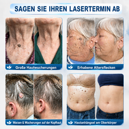1𝐇𝐈𝐒𝐊𝐈𝐍®👩‍⚕️ 𝟕-𝐓𝐚𝐠𝐞-𝐇𝐚𝐮𝐭𝐚𝐧𝐡ä𝐧𝐠𝐬𝐞𝐥- & 𝐅𝐥𝐞𝐜𝐤𝐞𝐧𝐞𝐧𝐭𝐟𝐞𝐫𝐧𝐞𝐫 – 𝐅𝐨𝐫𝐭𝐬𝐜𝐡𝐫𝐢𝐭𝐭𝐥𝐢𝐜𝐡𝐞𝐫 𝐑𝐨𝐥𝐥-𝐨𝐧-𝐒𝐭𝐢𝐟𝐭 𝐳𝐮𝐫 𝐬𝐜𝐡𝐦𝐞𝐫𝐳𝐟𝐫𝐞𝐢𝐞𝐧 𝐮𝐧𝐝 𝐧𝐚𝐫𝐛𝐞𝐧𝐟𝐫𝐞𝐢𝐞𝐧 𝐄𝐧𝐭𝐟𝐞𝐫𝐧𝐮𝐧𝐠 𝐯𝐨𝐧 𝐇𝐚𝐮𝐭𝐮𝐧𝐫𝐞𝐢𝐧𝐡𝐞𝐢𝐭𝐞𝐧（副本）
