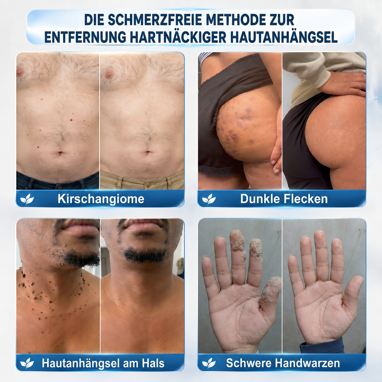 1𝐇𝐈𝐒𝐊𝐈𝐍®👩‍⚕️ 𝟕-𝐓𝐚𝐠𝐞-𝐇𝐚𝐮𝐭𝐚𝐧𝐡ä𝐧𝐠𝐬𝐞𝐥- & 𝐅𝐥𝐞𝐜𝐤𝐞𝐧𝐞𝐧𝐭𝐟𝐞𝐫𝐧𝐞𝐫 – 𝐅𝐨𝐫𝐭𝐬𝐜𝐡𝐫𝐢𝐭𝐭𝐥𝐢𝐜𝐡𝐞𝐫 𝐑𝐨𝐥𝐥-𝐨𝐧-𝐒𝐭𝐢𝐟𝐭 𝐳𝐮𝐫 𝐬𝐜𝐡𝐦𝐞𝐫𝐳𝐟𝐫𝐞𝐢𝐞𝐧 𝐮𝐧𝐝 𝐧𝐚𝐫𝐛𝐞𝐧𝐟𝐫𝐞𝐢𝐞𝐧 𝐄𝐧𝐭𝐟𝐞𝐫𝐧𝐮𝐧𝐠 𝐯𝐨𝐧 𝐇𝐚𝐮𝐭𝐮𝐧𝐫𝐞𝐢𝐧𝐡𝐞𝐢𝐭𝐞𝐧（副本）