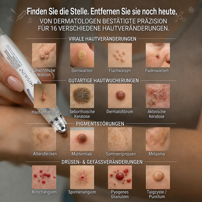1𝐇𝐈𝐒𝐊𝐈𝐍®👩‍⚕️ 𝟕-𝐓𝐚𝐠𝐞-𝐇𝐚𝐮𝐭𝐚𝐧𝐡ä𝐧𝐠𝐬𝐞𝐥- & 𝐅𝐥𝐞𝐜𝐤𝐞𝐧𝐞𝐧𝐭𝐟𝐞𝐫𝐧𝐞𝐫 – 𝐅𝐨𝐫𝐭𝐬𝐜𝐡𝐫𝐢𝐭𝐭𝐥𝐢𝐜𝐡𝐞𝐫 𝐑𝐨𝐥𝐥-𝐨𝐧-𝐒𝐭𝐢𝐟𝐭 𝐳𝐮𝐫 𝐬𝐜𝐡𝐦𝐞𝐫𝐳𝐟𝐫𝐞𝐢𝐞𝐧 𝐮𝐧𝐝 𝐧𝐚𝐫𝐛𝐞𝐧𝐟𝐫𝐞𝐢𝐞𝐧 𝐄𝐧𝐭𝐟𝐞𝐫𝐧𝐮𝐧𝐠 𝐯𝐨𝐧 𝐇𝐚𝐮𝐭𝐮𝐧𝐫𝐞𝐢𝐧𝐡𝐞𝐢𝐭𝐞𝐧（副本）