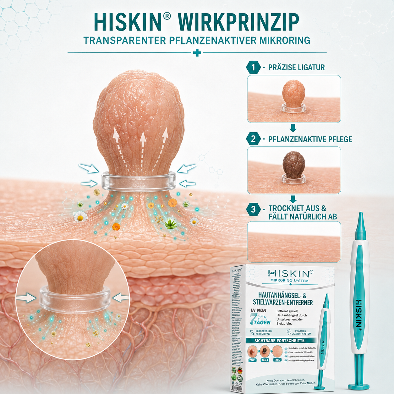 3𝐇𝐈𝐒𝐊𝐈𝐍®👩‍⚕️ 𝟕-𝐓𝐚𝐠𝐞-𝐇𝐚𝐮𝐭𝐚𝐧𝐡ä𝐧𝐠𝐬𝐞𝐥- & 𝐅𝐥𝐞𝐜𝐤𝐞𝐧𝐞𝐧𝐭𝐟𝐞𝐫𝐧𝐞𝐫 – 𝐅𝐨𝐫𝐭𝐬𝐜𝐡𝐫𝐢𝐭𝐭𝐥𝐢𝐜𝐡𝐞𝐫 𝐑𝐨𝐥𝐥-𝐨𝐧-𝐒𝐭𝐢𝐟𝐭 𝐳𝐮𝐫 𝐬𝐜𝐡𝐦𝐞𝐫𝐳𝐟𝐫𝐞𝐢𝐞𝐧 𝐮𝐧𝐝 𝐧𝐚𝐫𝐛𝐞𝐧𝐟𝐫𝐞𝐢𝐞𝐧 𝐄𝐧𝐭𝐟𝐞𝐫𝐧𝐮𝐧𝐠 𝐯𝐨𝐧 𝐇𝐚𝐮𝐭𝐮𝐧𝐫𝐞𝐢𝐧𝐡𝐞𝐢𝐭𝐞𝐧（副本）（副本）